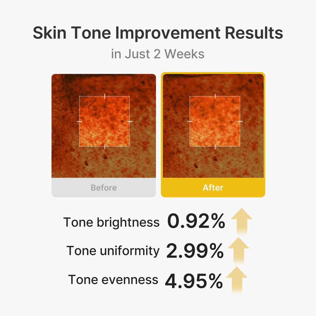 Kojic Acid Turmeric Vita Capsule Cream N0