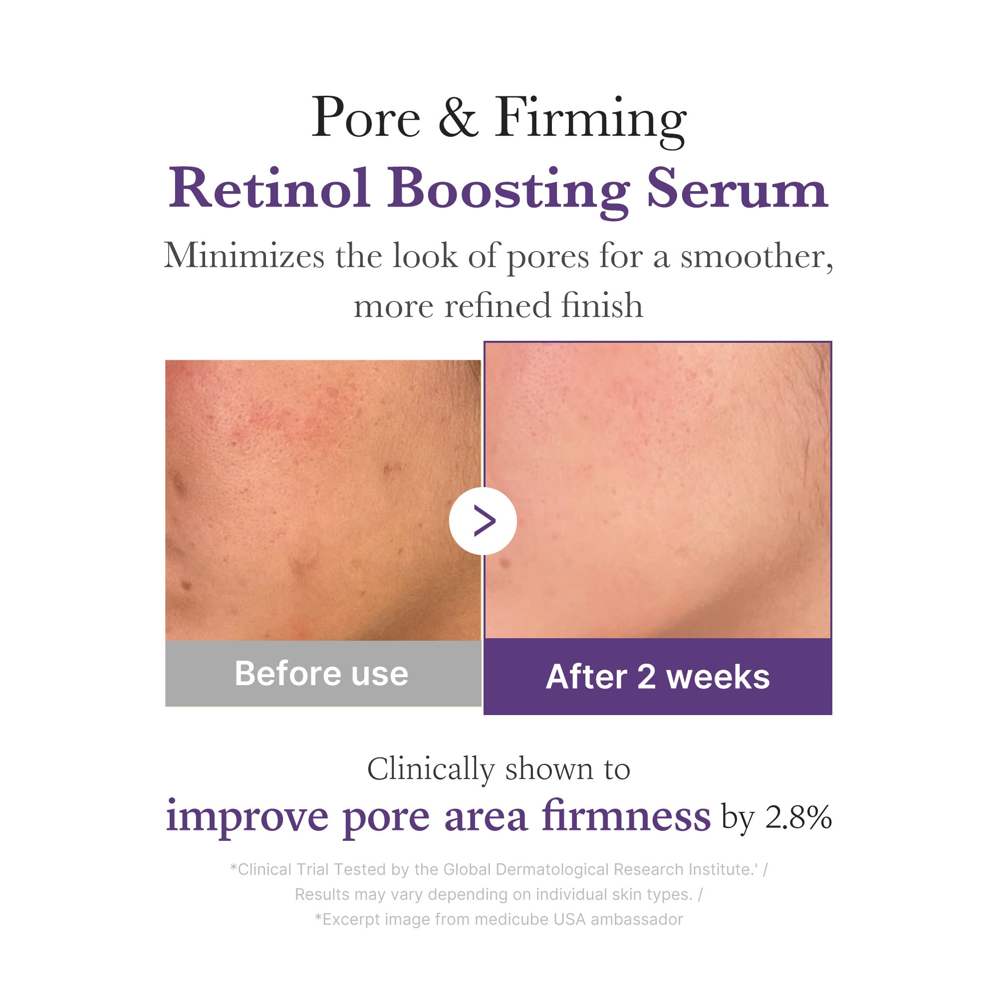 Retinol NMN Boosting Serum I9