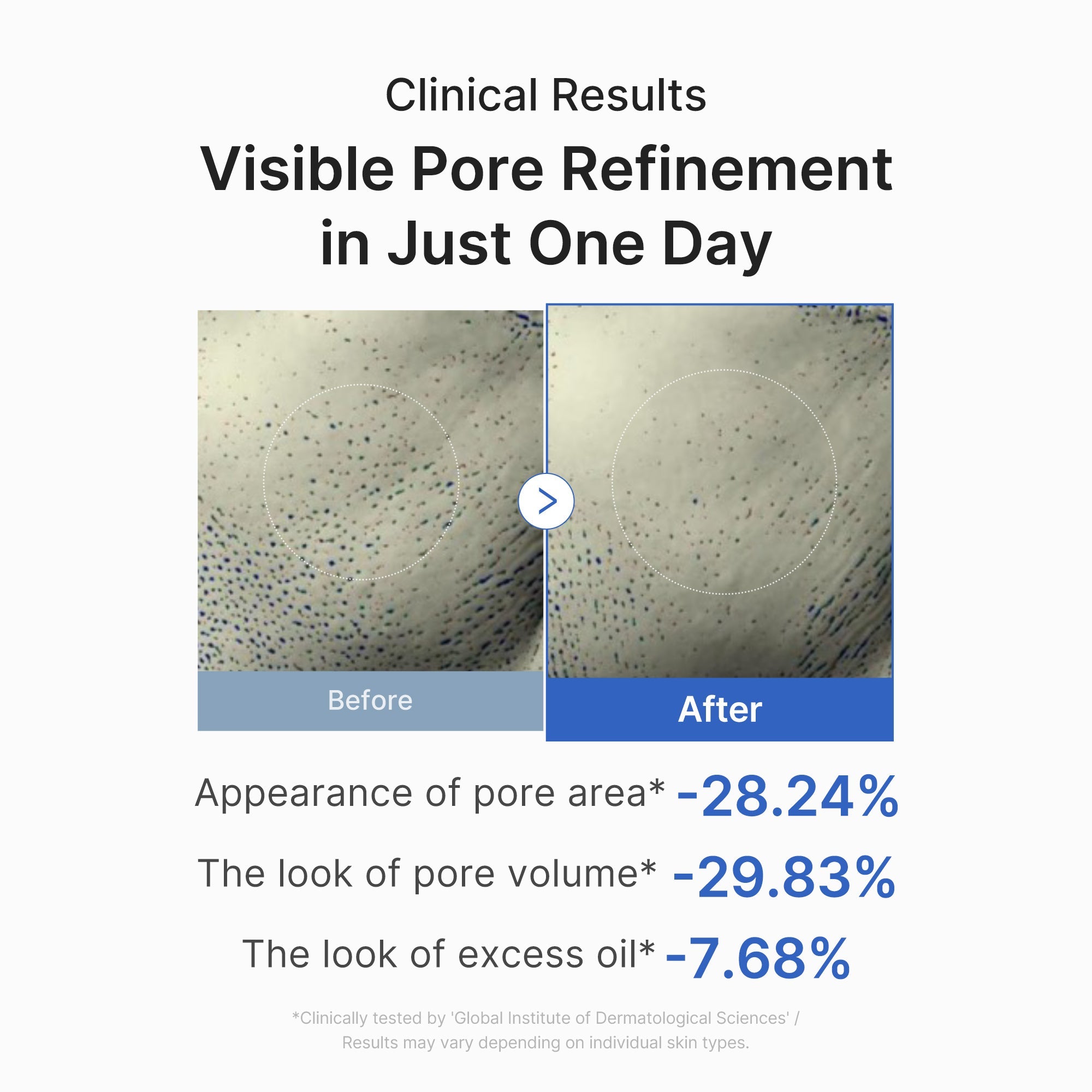 Zero Pore One-day Peptide Serum J8