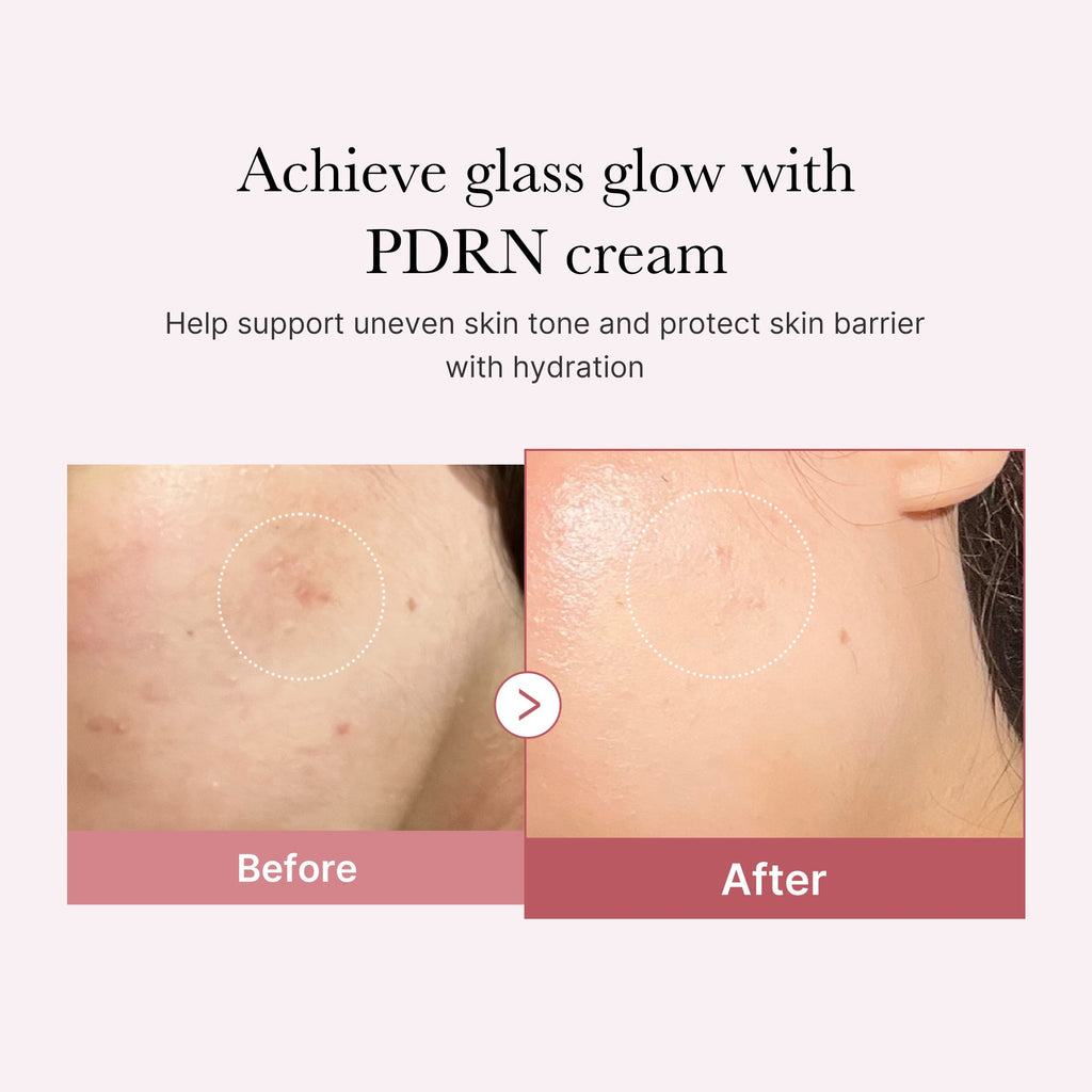 PDRN Pink Peptide Cream H5